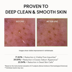 Green Rice Facial Cleansing Balm